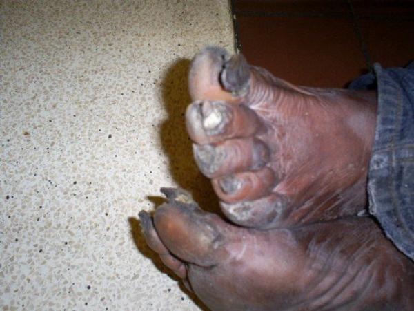 Feet for sale pics ugly 